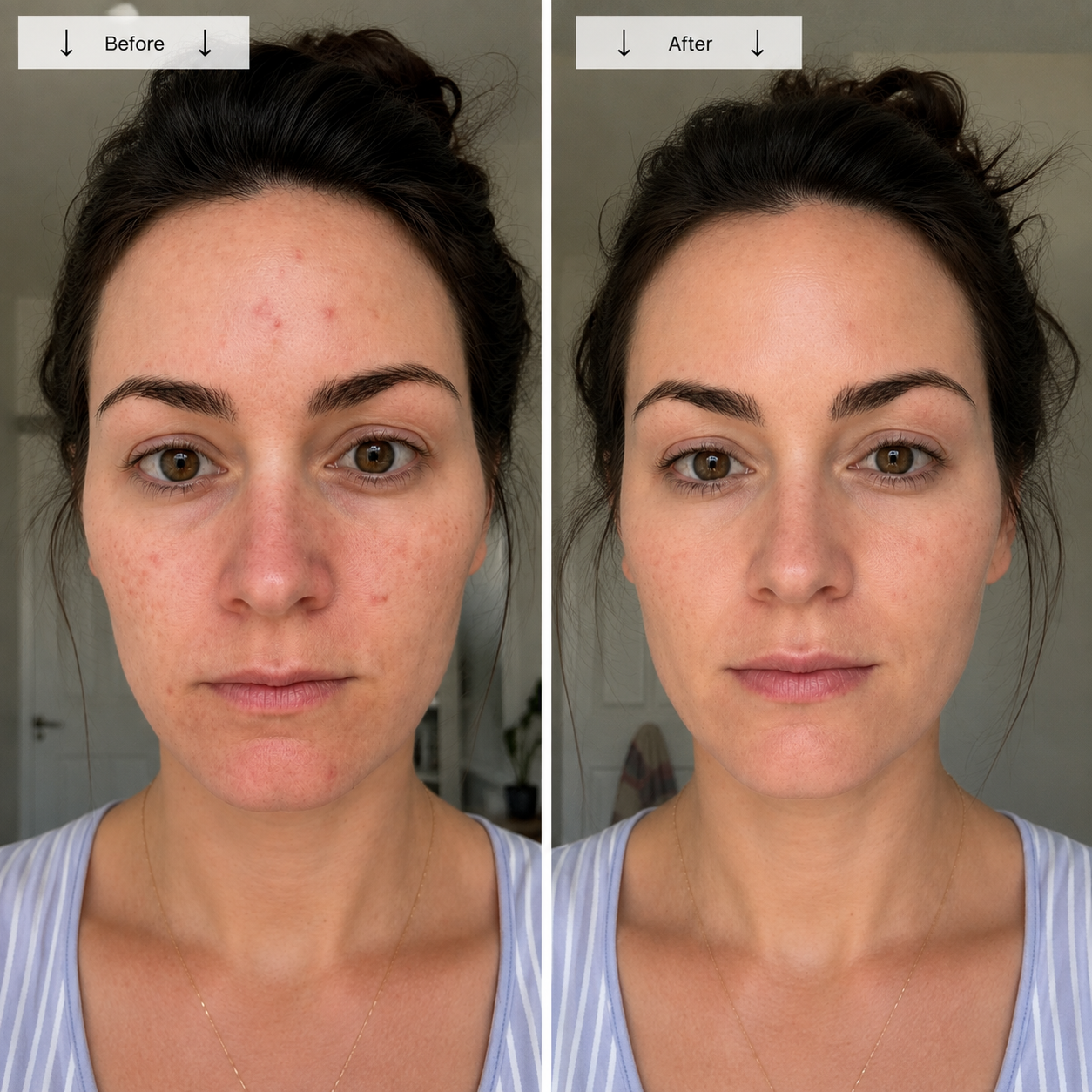 Gadecci LED Face Mask